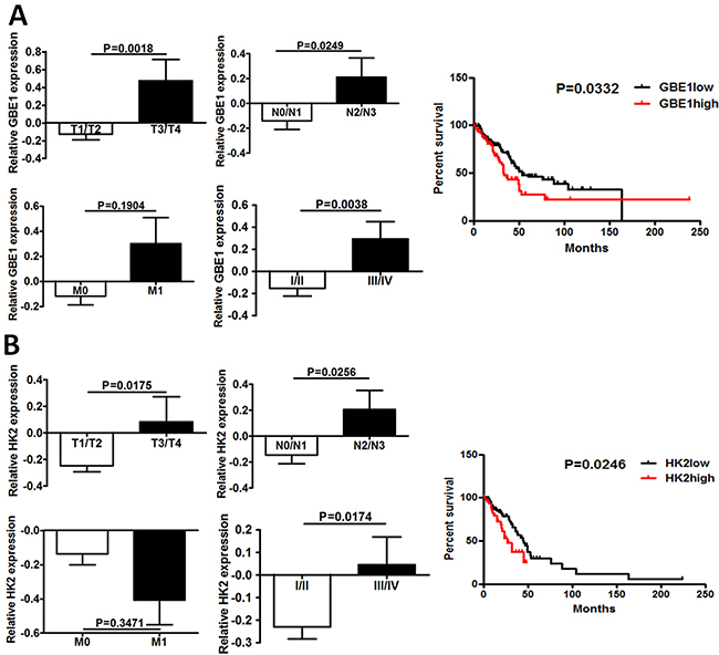 GBE1 and HK2 expression is associated with poor prognosis in lung adenocarcinoma patients.