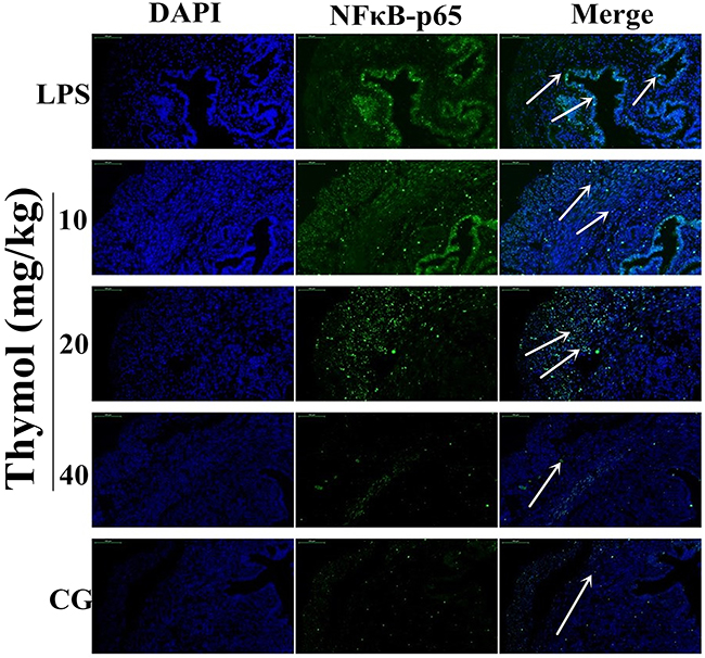 Effects of thymol on NF-&#x03BA;B p65 translocation into the nucleus.