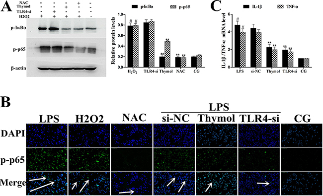 A. Effects of H2O2 on NF-&#x03BA;B activation after silencing of TLR4 in RAW264.7 cells.