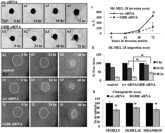 Growth hormone receptor knock-down (GHRKD) attenuates invasion, migration and clonogenicity in human melanoma cells.