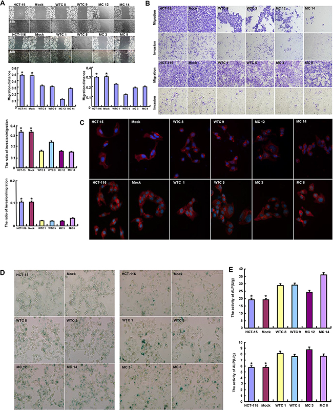 The effects of parafibromin on migration, invasion, senescence and differentiation of colorectal cancer cells.