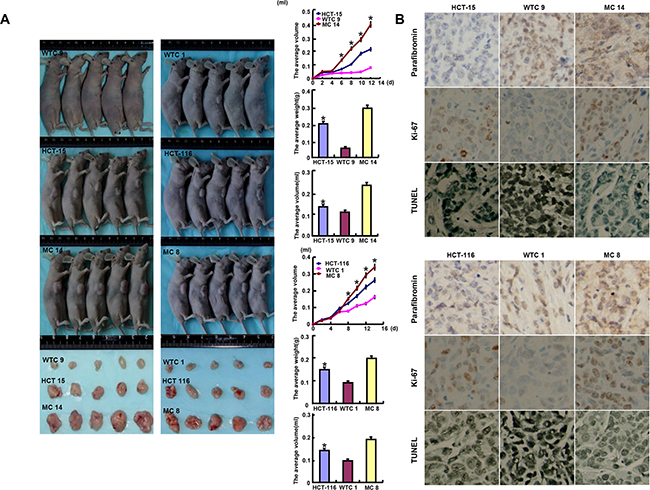 The roles of parafibromin overexpression on the tumor growth of colorectal cancer cells in nude mice.