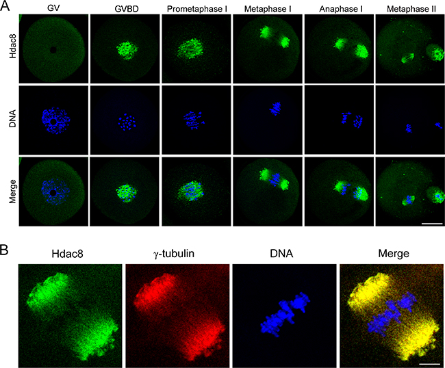 Subcellular localization of HDAC8 during mouse meiotic maturation.