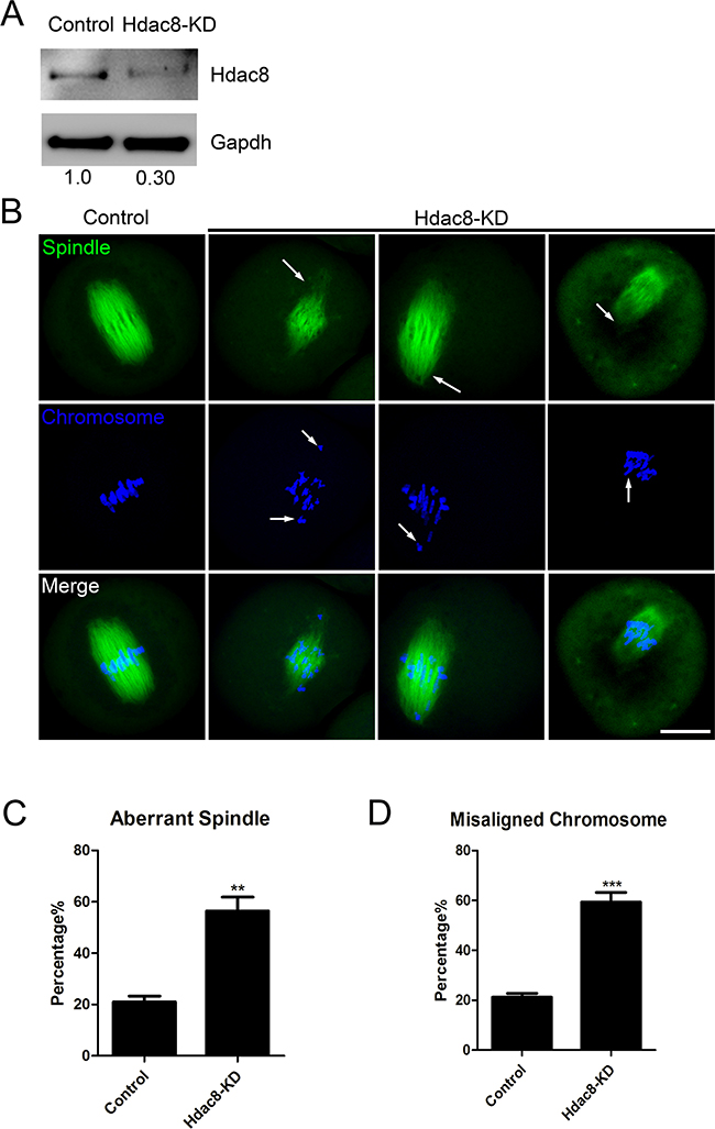 Depletion of HDAC8 causes spindle and chromosome abnormalities.