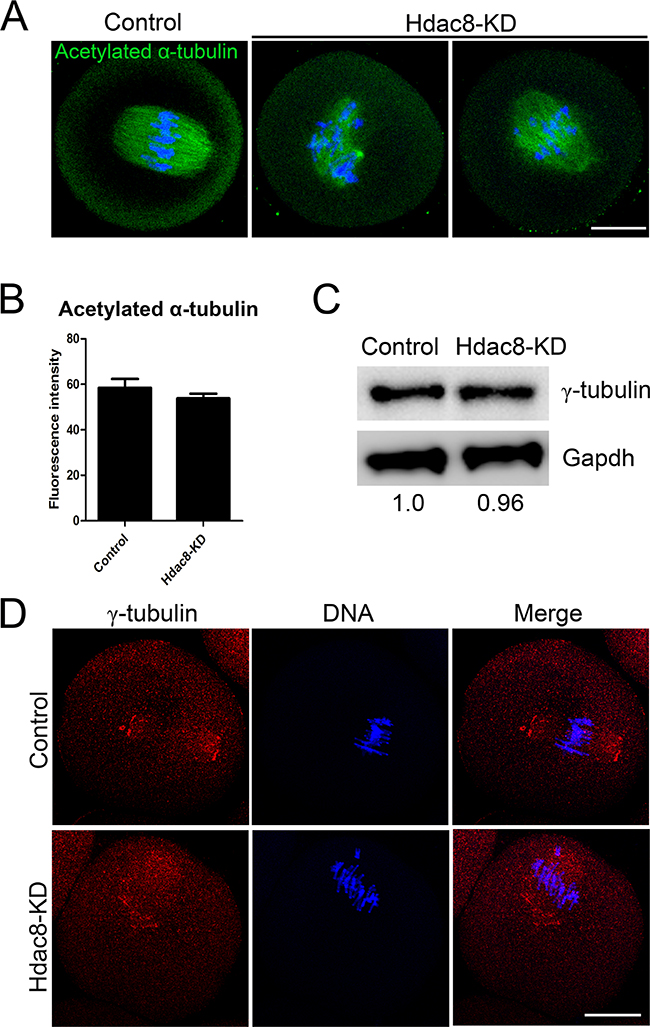 Depletion of HDAC8 disrupts the localization of &#x03B3;-tubulin in mouse oocytes.
