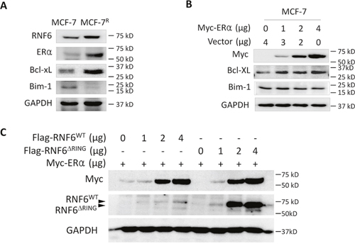 RNF6 promotes the ER&#x03B1;/Bcl-xL axle in breast cancer.