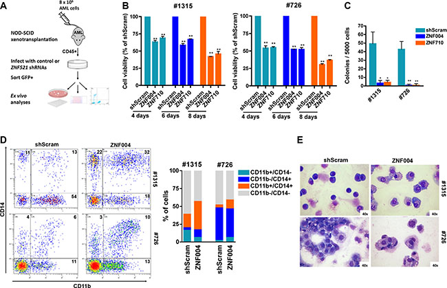 ZNF521 depletion impairs cell growth and induces differentiation on primary MLL-AF9 AML patient-derived xenograft cells.