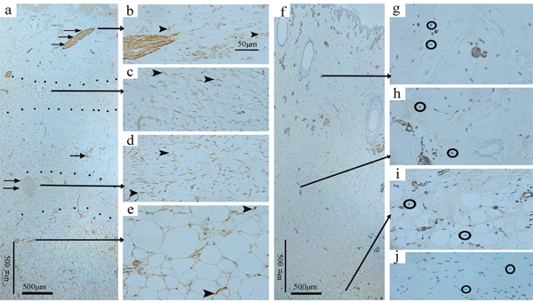 Immunohistochemical staining of a-SMA in the deep dermis group at 2 weeks post-wounding and the normal skin.