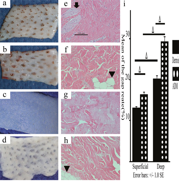 Macroscopic and histological observations of the deep/superficial dermis and ADM.