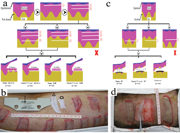 Establishment and grouping of wound models on the FRDPs.