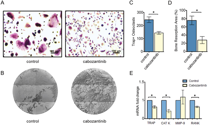 Effect of cabozantinib treatment on primary osteoclasts.