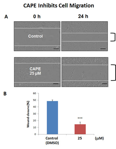 CAPE decreases the migratory capacity of MCF7 cells.