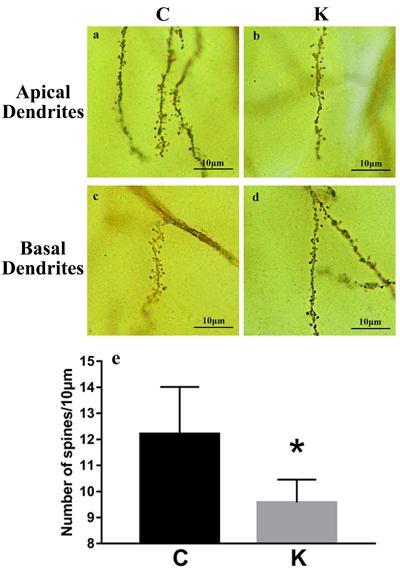 Golgi staining revealed hippocampal dendritic spine density.