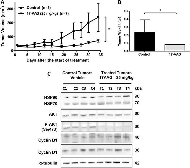 In vivo efficacy of 17-AAG on human GBC xenografts.