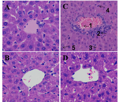 Effect of DIOS on liver tissue of AHF mice after administration of LPS/D-GalN endotoxin.