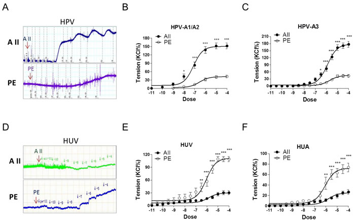 Angiotensin II and PE induced concentration-dependent vasoconstrictions in HPV, HUV, and HUA.