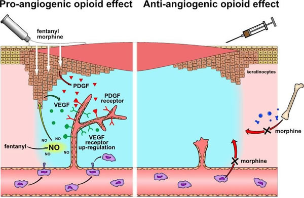 Wound angiogenesis under the influence of opioids.