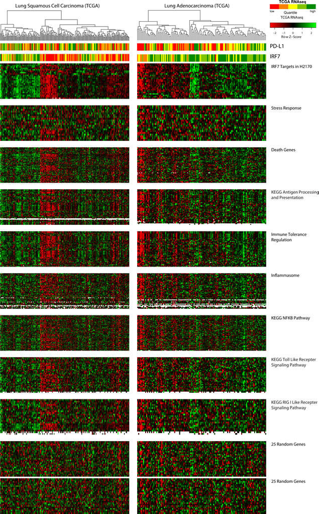 Relationship of azacytidine-induced, immune-related pathways to primary lung tumors grouped by expression of IRF7-associated genes.