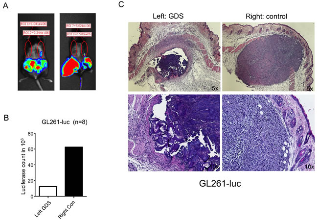 GDS prevented tumor seeding in biopsy of subcutaneous GL261 tumor.