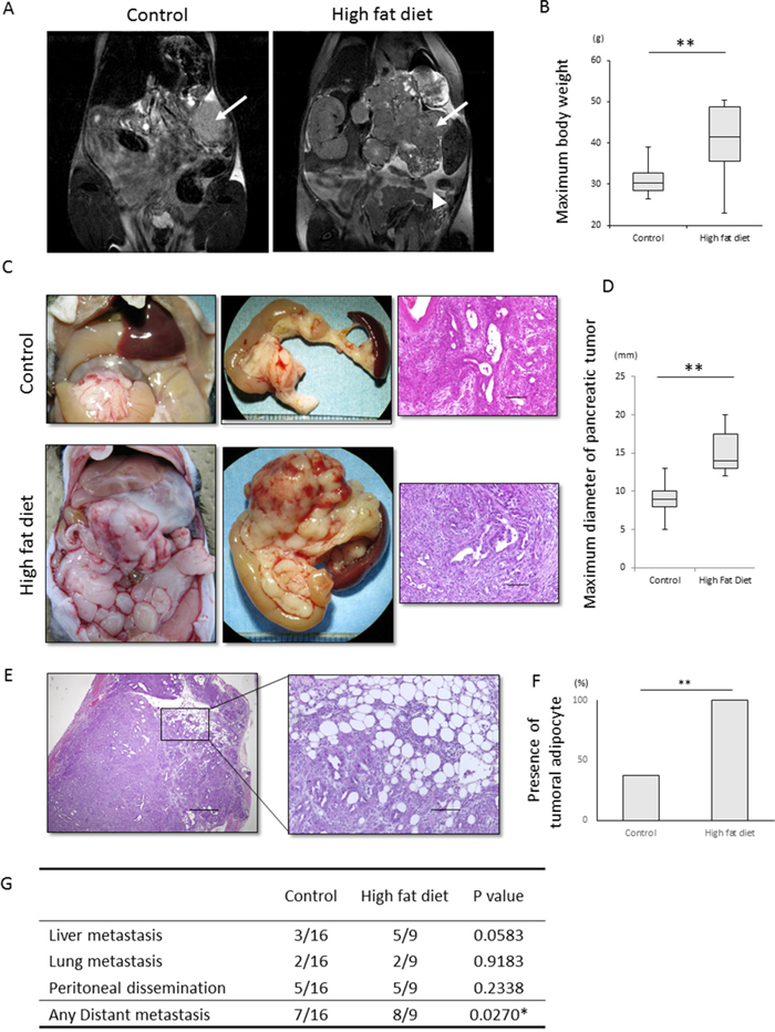 Effect of a high fat diet on the macroscopic appearance and histology of KPC tumors.