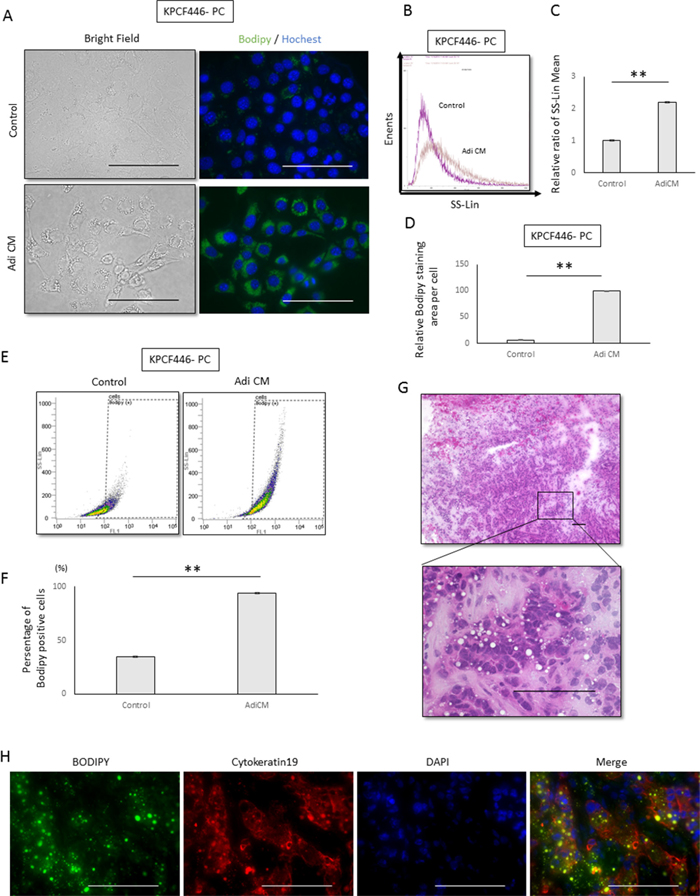 Effects of adipose tissue conditioned medium (Adi CM) on the morphology of pancreatic cancer cells.