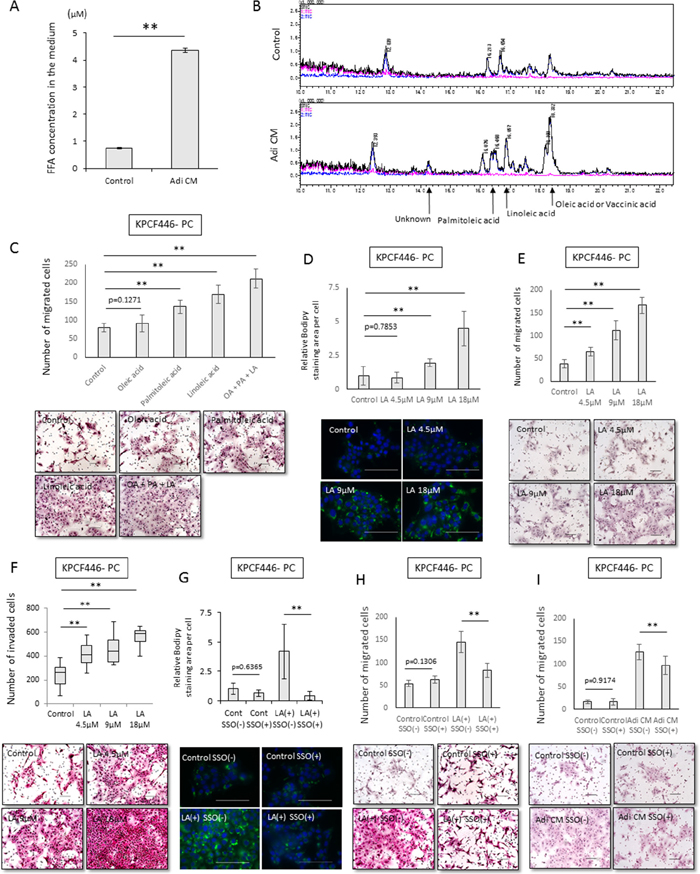 Effects of Adi CM on fatty acid incorporation into cancer cells and tumor cell migration.
