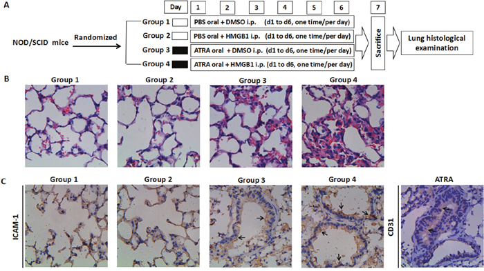 Effects of HMGB1 on pulmonary infiltration in mice.