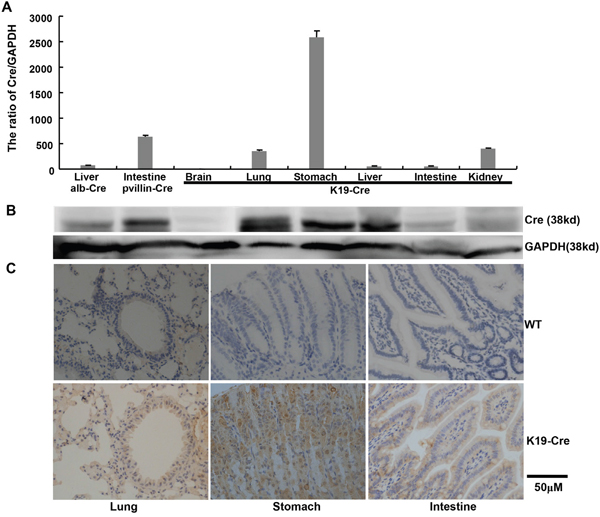 Cre expression in the organs of K19-Cre transgenic mice.