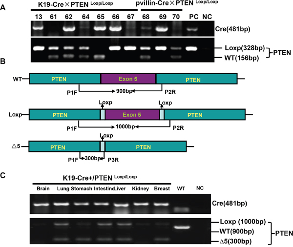 K19-Cre-mediated PTEN deletion in conditional knockout mice.