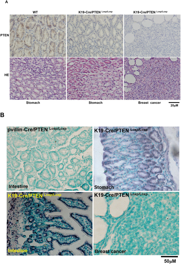 Breast carcinogenesis in transgenic mice with tissue-specific abrogation of PTEN.