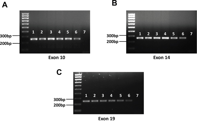 Detection of representative exons of c-MET from PEL cell-lines.