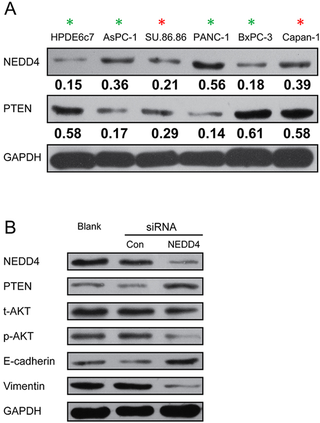 NEDD4 is heterogeneously expressed in PDAC cells and cross-talk with the PTEN/PI3K/AKT signaling pathway.