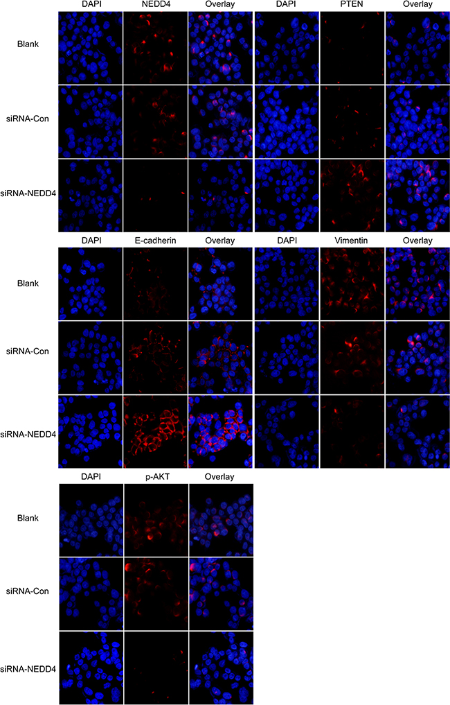 NEDD4 may affect PTEN/PI3K/AKT signaling pathways.