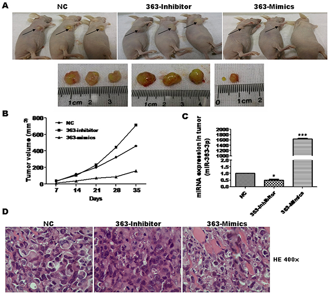 miR-363-3p significantly inhibited cell growth in nude mouse xenograft model.