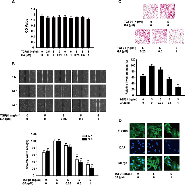 GA inhibits TGF&#x03B2;1-induced migration and invasion of A549 cells in vitro.