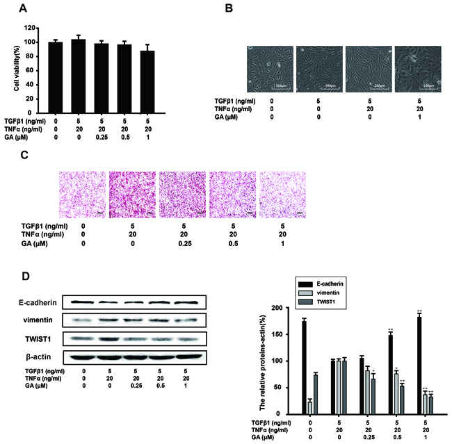 GA inhibits TGF&#x03B2;1+TNF&#x03B1;-induced EMT and the invasion of A549 cells.