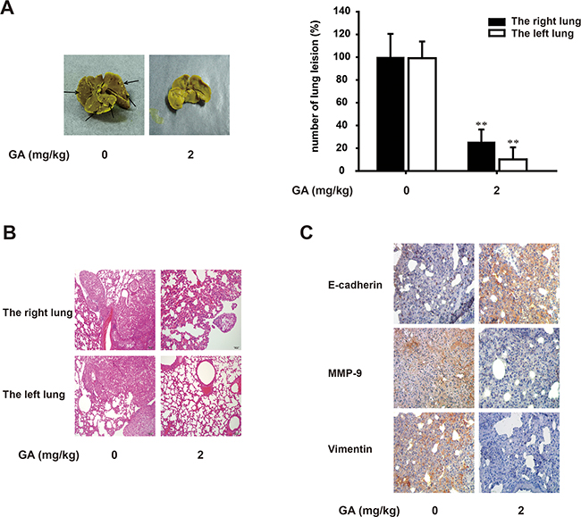 GA suppresses lung growth and metastasis of A549 cells in vivo.