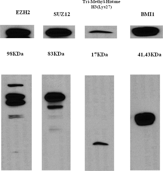 Western blot analysis of EZH2, SUZ12, H3K27me3, and BMI-1 in the HH cell line.