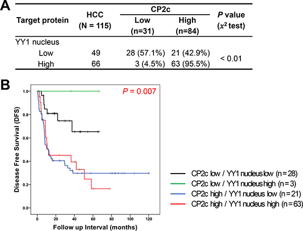 Prognostic significance of combined detection of high CP2c and nuclear YY1 expression in HCC patients.