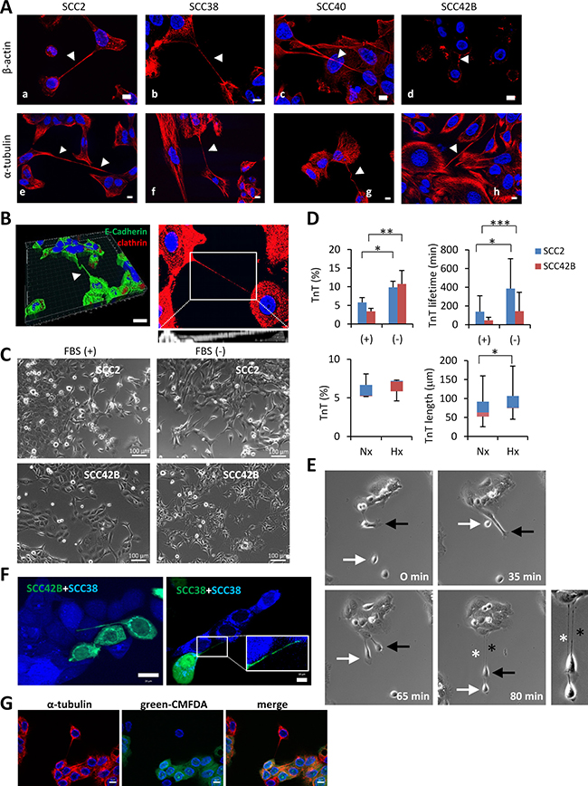 Similarities of long cell projections in SCC-derived cells with TnTs.