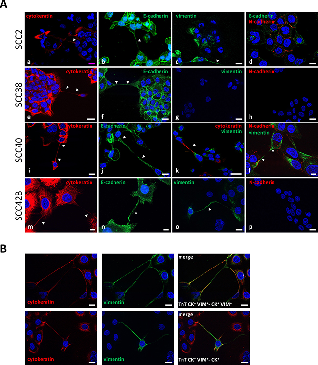 TnTs establish connections between mesenchymal and epithelial cancer cells.