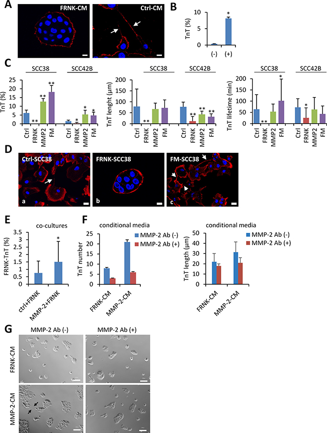 Rescue of TnT formation in FAK-deficient cells.