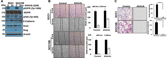 Afatinib inhibits Epithelial to Mesenchymal transition in HNSCC cells.