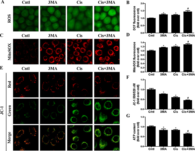 Effect of autophagy inhibitor on cisplatin-induced mitochondrial dysfunction.