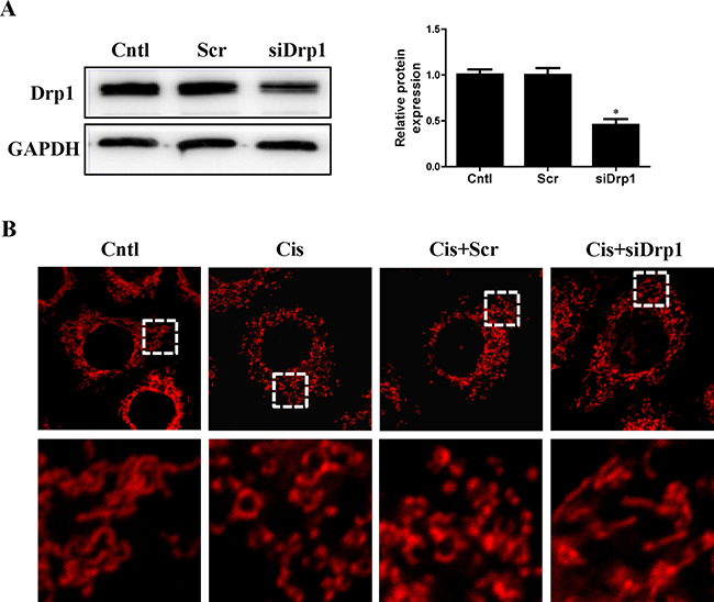 Effect of Drp1 silencing on cisplatin-induced mitochondrial fission.
