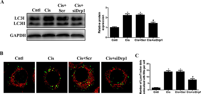 Effect of Drp1 siRNA on cisplatin-induced mitophagy.