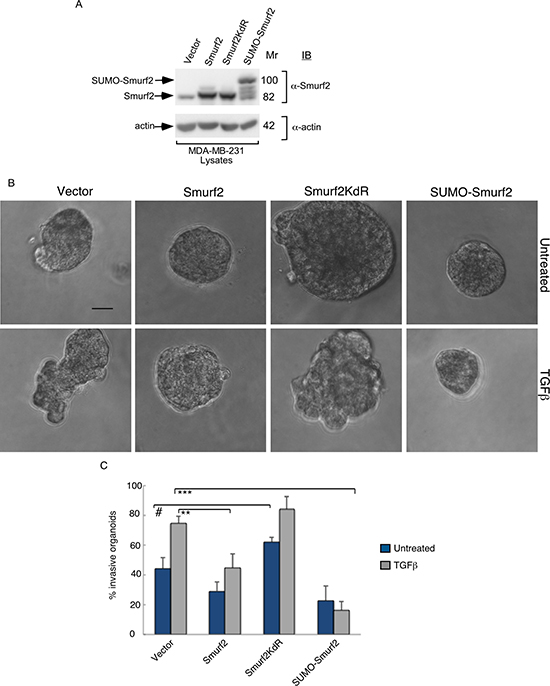 Smurf2 suppresses TGF&#x03B2;&#x2013;induced invasive growth of MDA-MB-231 cell-derived organoids in a sumoylation-dependent manner.