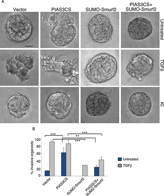 SUMO-Smurf2 reverses PIAS3CS to induce invasive growth of MDA-MB-231 breast cancer cell-derived organoids.