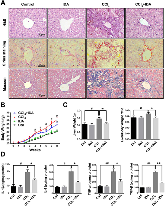 IDA attenuates the progression of liver fibrosis in CCl4-treated mice.