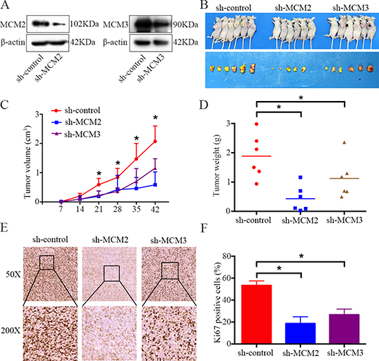 Knockdown of MCM2 or MCM3 inhibits osteosarcoma cell growth